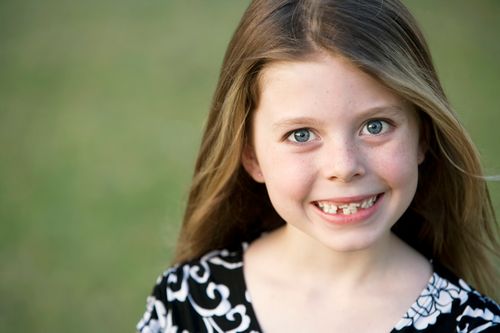 Damaged teeth of a smiling girl which represents the 