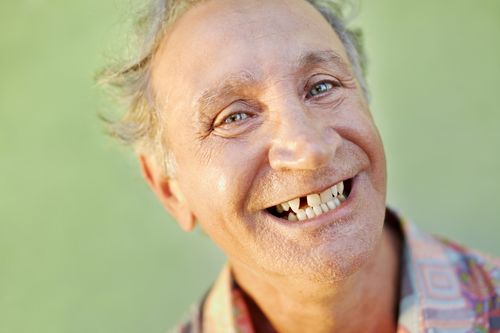 A smiling man with damaged teeth which represents the 