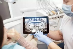 Dental x-rays shown on a tablet which represents the "why do i need dental x rays" blog.