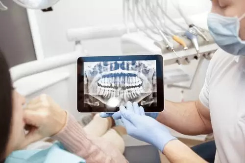 Dental x-rays shown on a tablet which represents the 